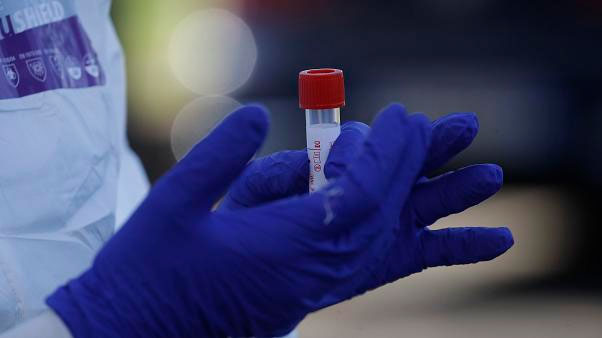 España e Italia frenan avance COVID (+vídeo) 1 Mano muestra laboratorio FE