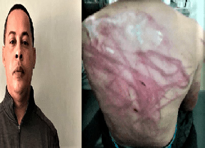 Padre flageló espalda de hijo con cable de acero en Villa Vásquez provincia Montecristi 5 Padre flageló espalda de hijo con cable de acero en Villa Vásquez provincia Montecristi