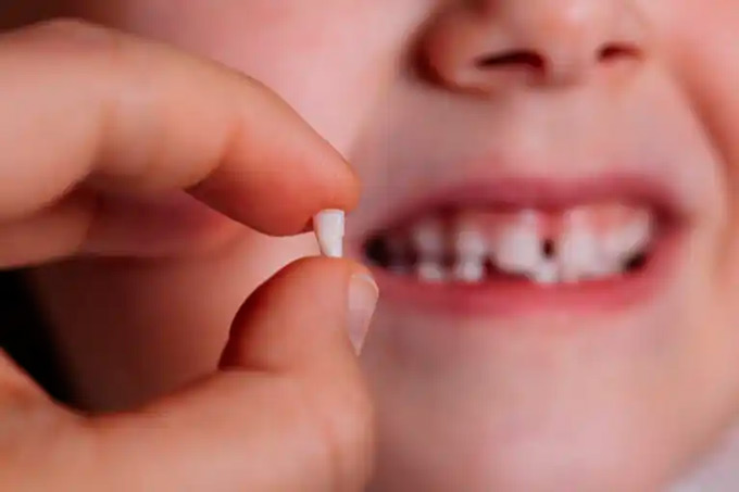 Bancos de dientes de leche: una fuente de células madre 1 Diente leche FE