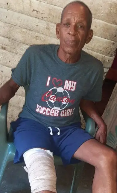 Hombre atacado por cocodrilo narra la angustia que vivió