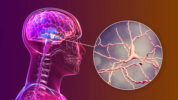 ¿Por qué se celebra hoy el Día Mundial del Parkinson? 2 ¿Por qué se celebra hoy el Día Mundial del Parkinson?