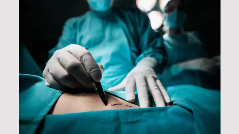 Mujer se hizo cirugía estética y luego salió corriendo del hospital para no pagarla