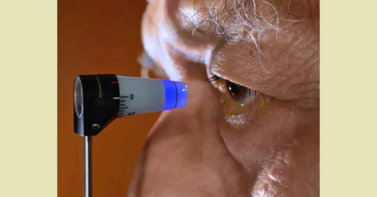 Ceguera por glaucoma puede evitarse en mayoría de los casos 1 Ceguera por glaucoma puede evitarse en mayoría de los casos