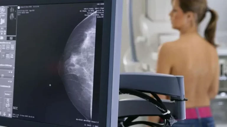 Cáncer de mama: las desigualdades socioeconómicas afectan la calidad de vida de las pacientes