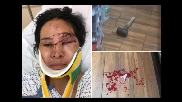Piden ayuda para mujer golpeada con un martillo en una bodega de El Bronx