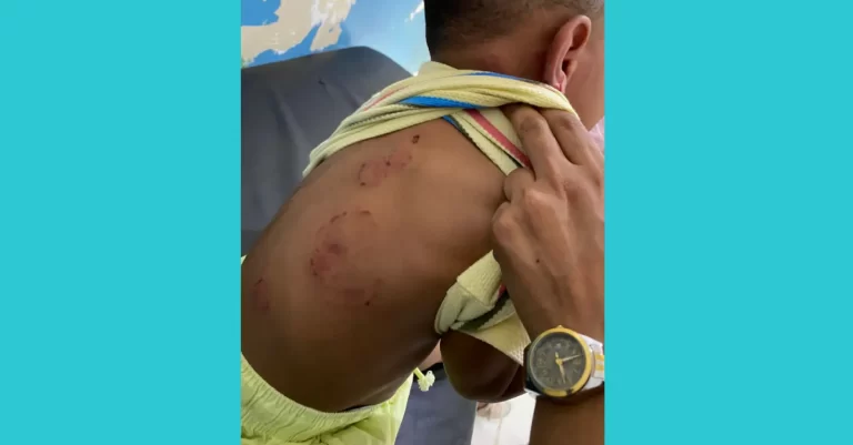 Niño sufre agresión salvaje en el Caipi