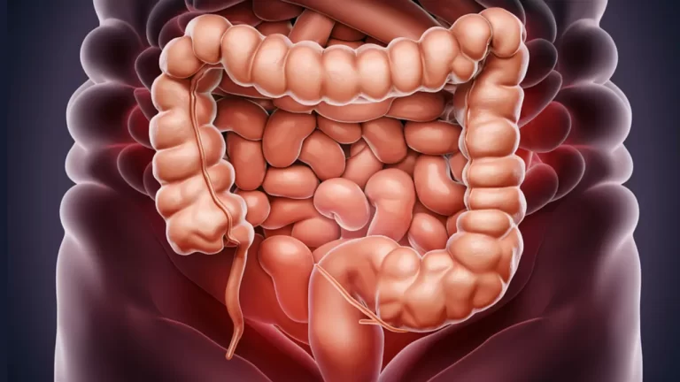 Los cánceres de colon están aumentando de forma alarmante entre los jóvenes. Tenemos un sospechoso: el sedentarismo 3 Los cánceres de colon están aumentando de forma alarmante entre los jóvenes