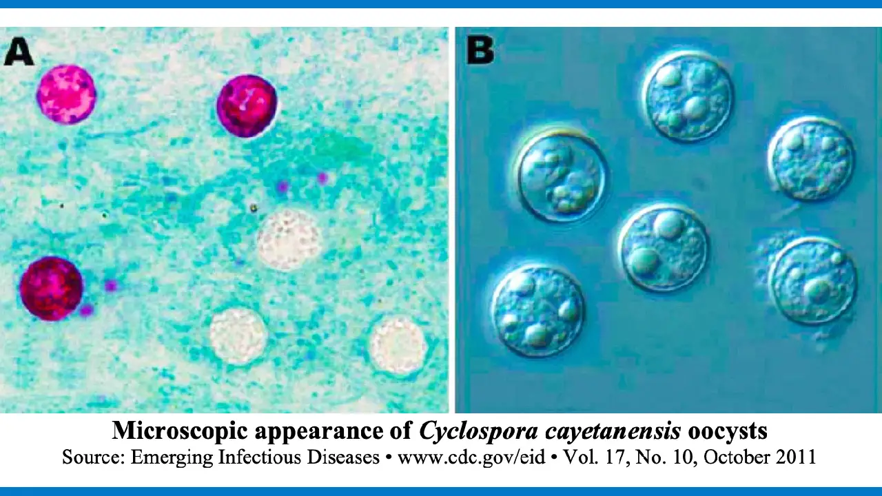 EE. UU. investiga brote de ciclosporiasis 1 brote de ciclosporiasis
