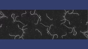 leptospirosis