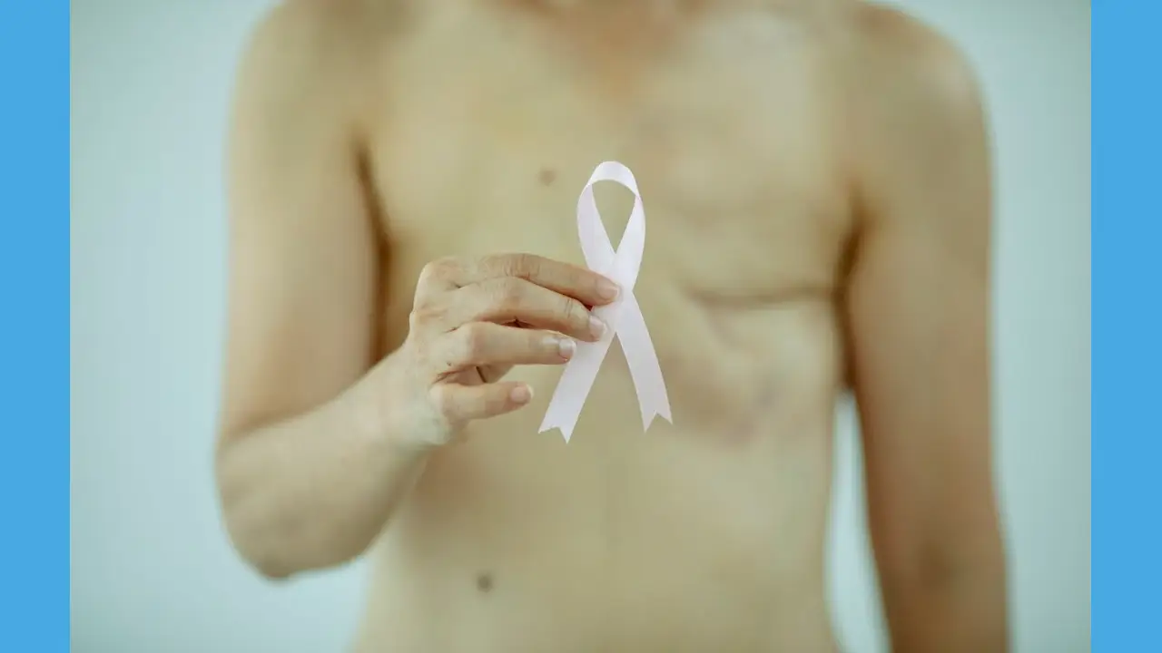 Cáncer de mama masculino aumenta con la edad 1 cáncer de mama masculino