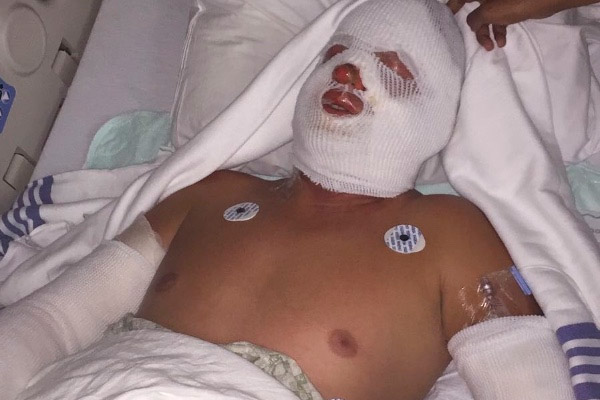 Nelson Madera Charlie FE 1