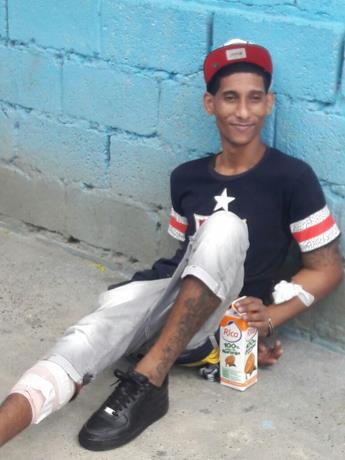 Versiones de los reclusos heridos en la cárcel de Baní donde mataron al “preboste”