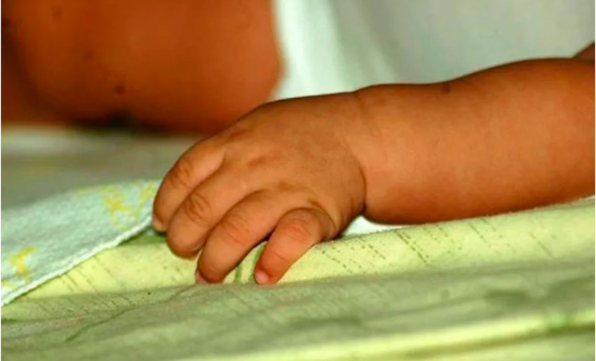 Madre quemó manos a niño de 1 año con agua caliente 1 Mano nino FE