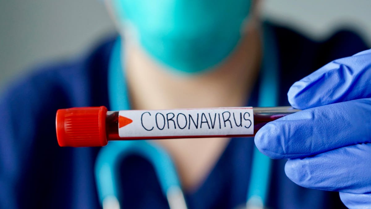 Prueba coronavirus