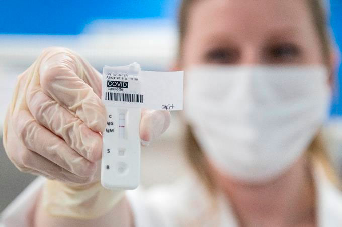 Aumentan a 3,286 casos de coronavirus; 119 son nuevos