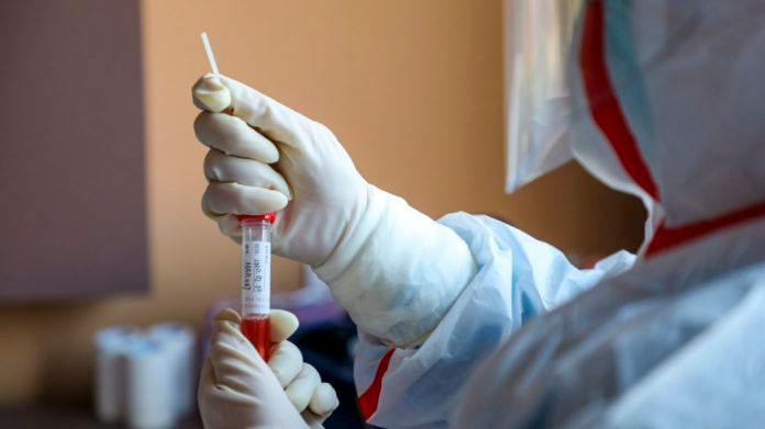 Hoy se inician en Rep. Dominicana las pruebas rápidas sobre el coronavirus