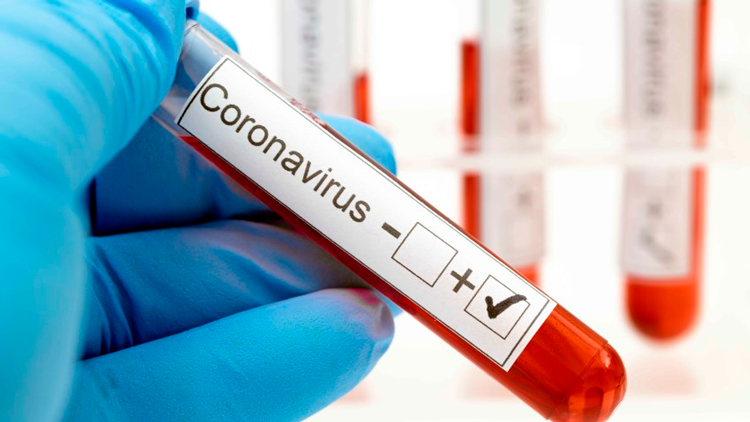 Coronavirus FE