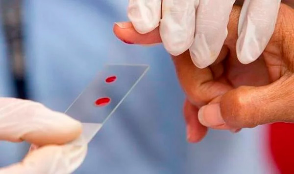 Día Mundial de la Hemofilia: un padecimiento silencioso que no tiene cura