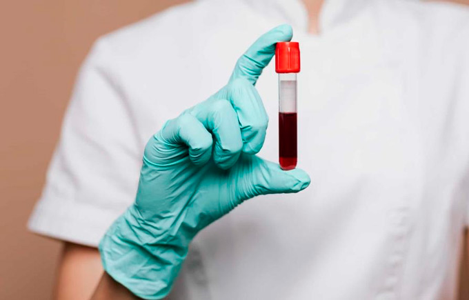 ¿Cuál es el tipo de sangre más común en República Dominicana?