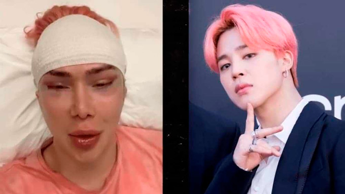 Gastó 152,000 dólares en cirugías para parecerse a Jimin de BTS – video