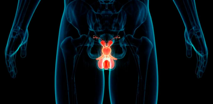 El cáncer de próstata es el segundo más común en República Dominicana