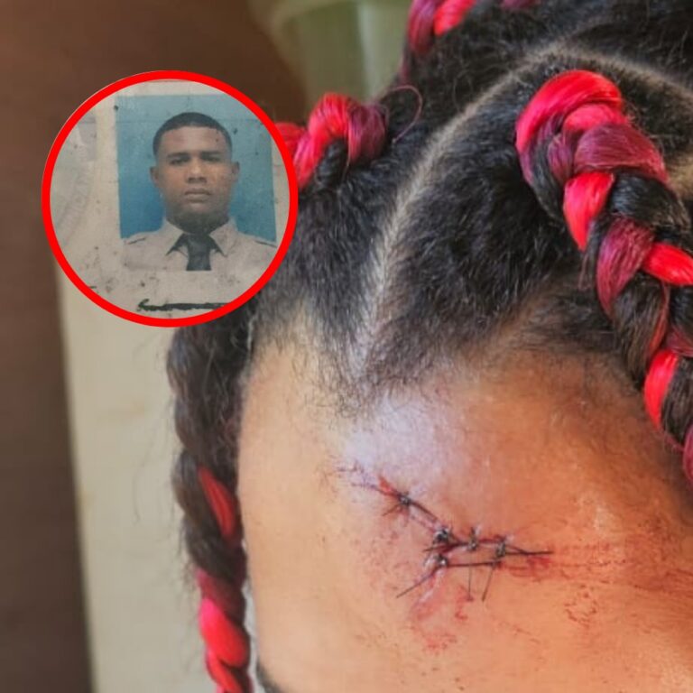 Apresan en Montecristi a sargento PN propinó golpiza a su pareja menor de edad y a una hermana de esta