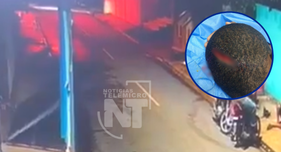 (Vídeo) Menor de 10 años casi pierde la vida tras ser aplastado por un portón