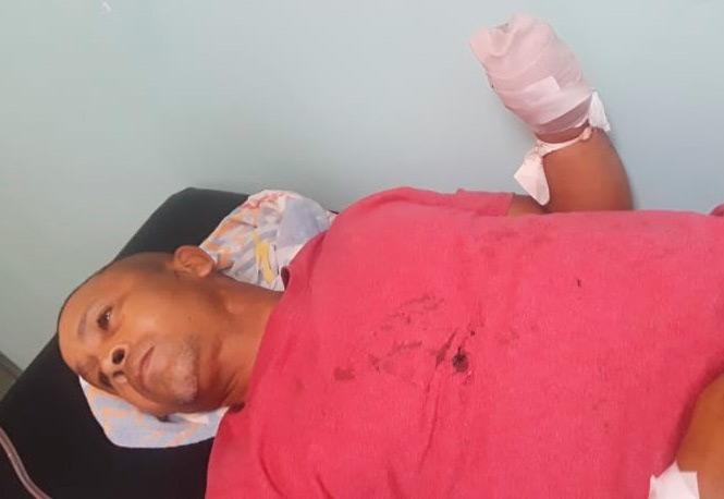 DAJABÓN: Le cercenan una mano a un regidor del PRM durante riña 4 DAJABÓN: Le cercenan una mano a un regidor del PRM durante riña