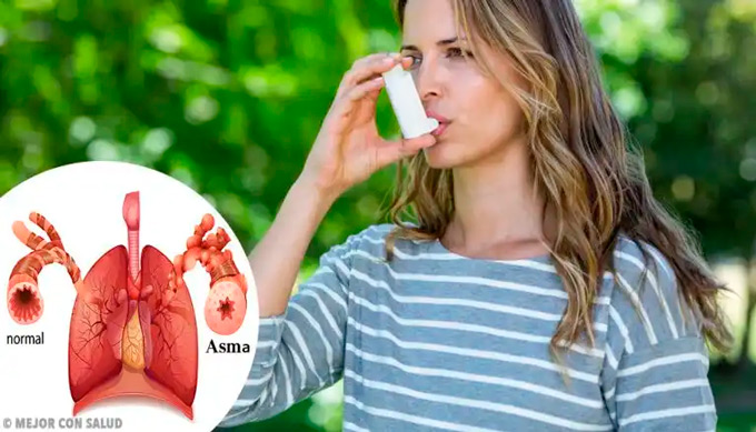 Asma 2 Asma